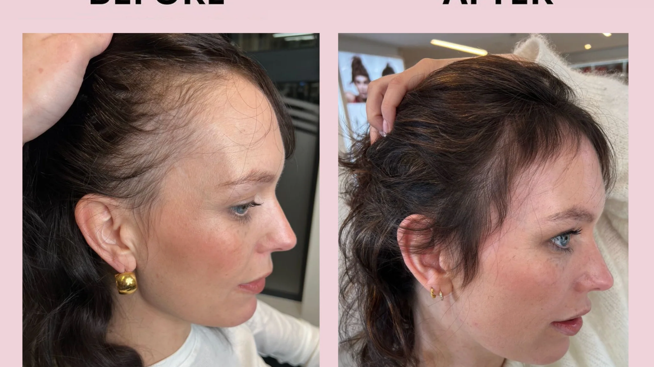 Why We Recommend Glowwa Hair Food Supplements at Rosser Hair
