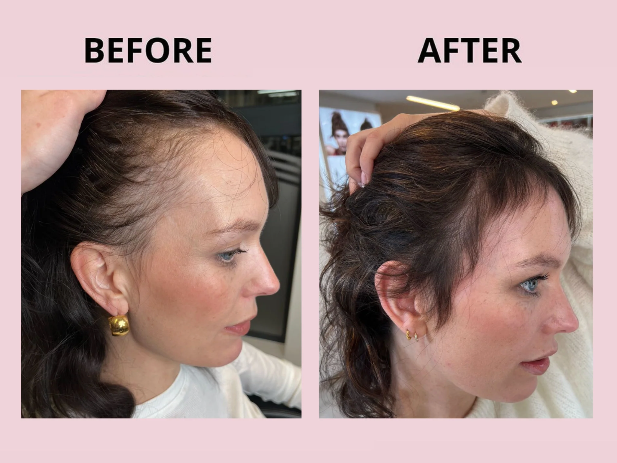 Why We Recommend Glowwa Hair Food Supplements at Rosser Hair