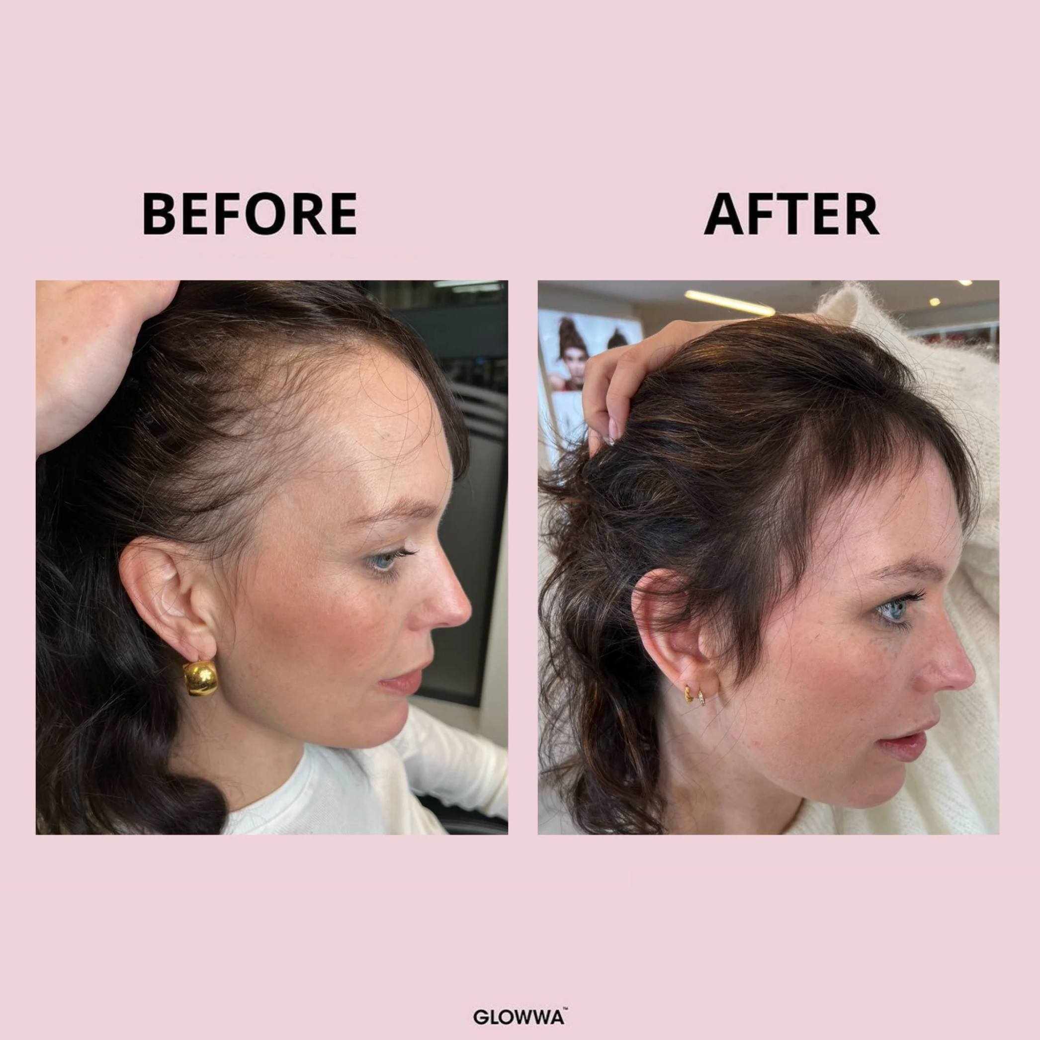 Why We Recommend Glowwa Hair Food Supplements at Rosser Hair